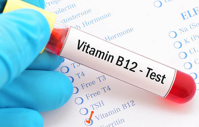 Metformina e carenza di Vitamina B 12