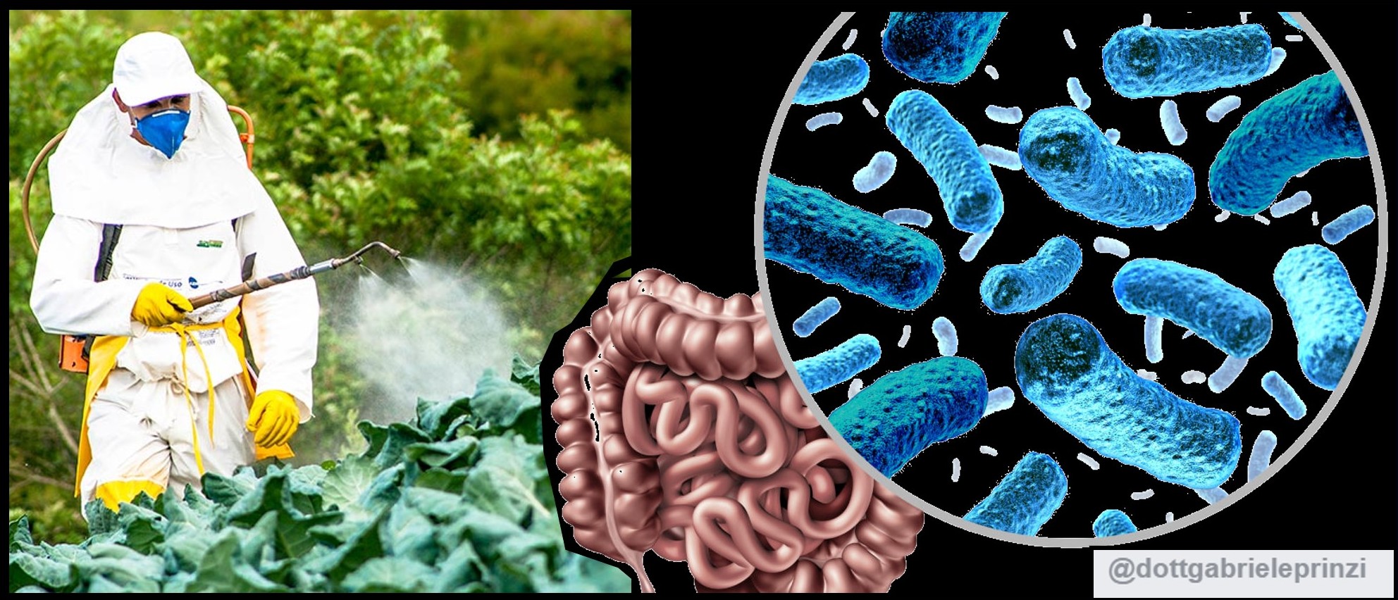 Il Glifosato danneggia seriamente il Microbiota Intestinale.